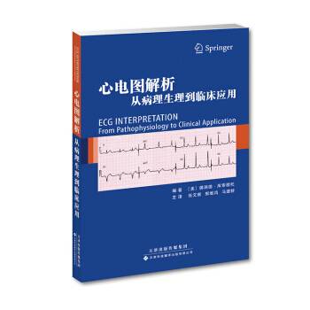 心电图解析