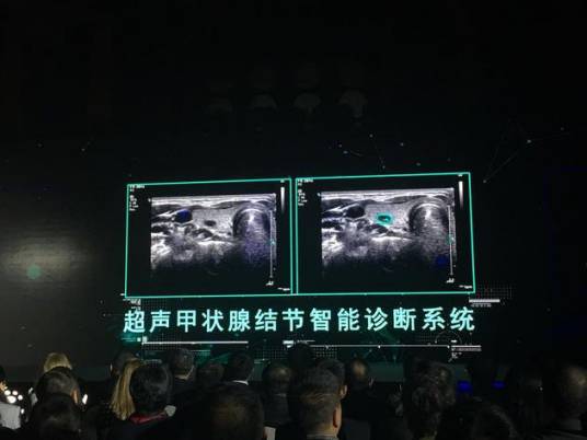 ET医疗大脑