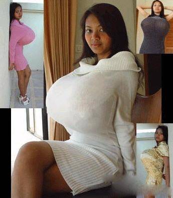 巨乳缩小术