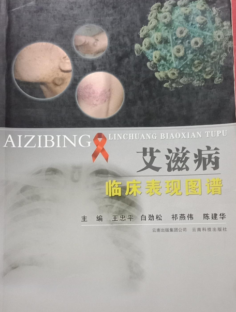艾滋病临床表现图谱