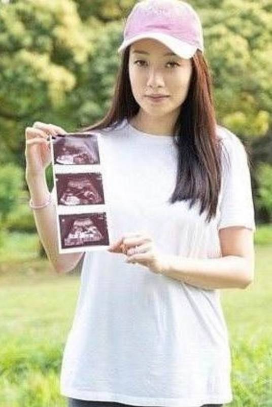 Donna（歌手柯有伦的妻子）