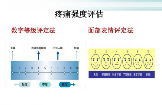 疼痛强度的评定