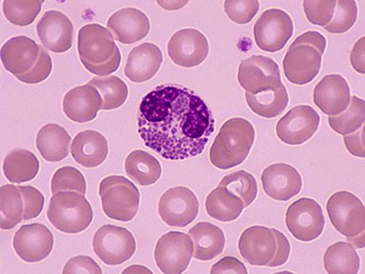 嗜酸性粒细胞(血液细胞)