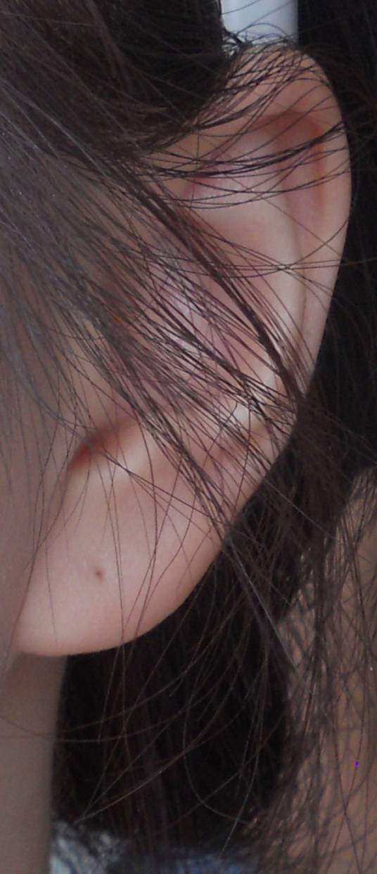 耳洞（广义上的耳洞）