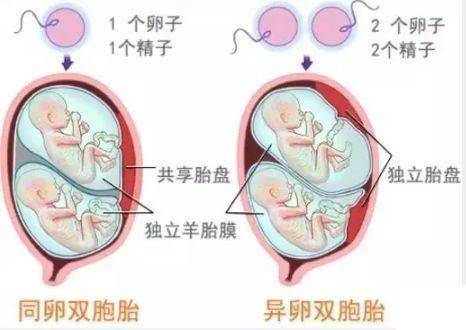 同卵双胞胎