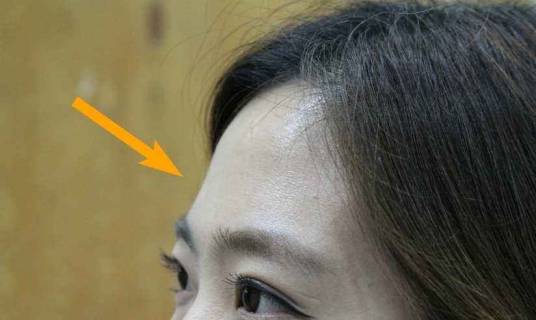 额头（人脸的部位）