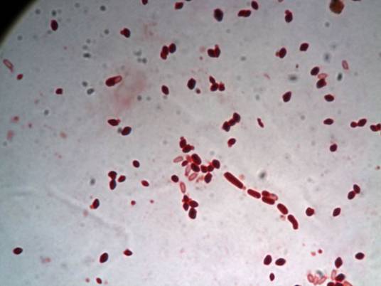 苏云金杆菌（包括许多变种的一类产晶体的芽孢杆菌）