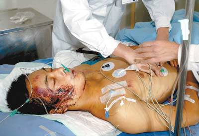 重伤（法律概念）